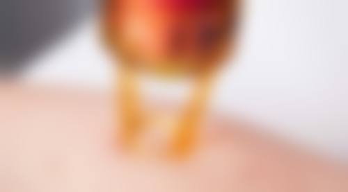 三、肚子吸脂风险的预防措施