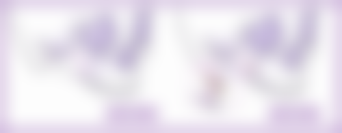 {做了吸脂手术会反弹吗？权威解析吸脂术后反弹真相与维持效果秘诀 