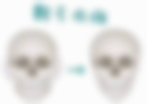 一、瘦脸针常见副作用及表现