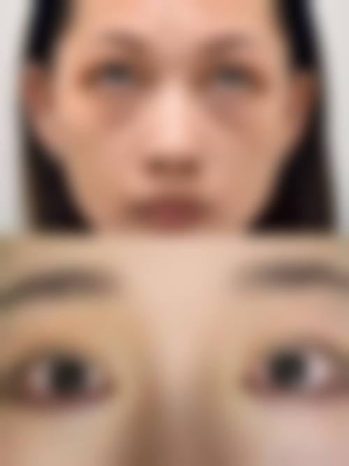 八、济南心艺医疗美容诊所真实的患者评价