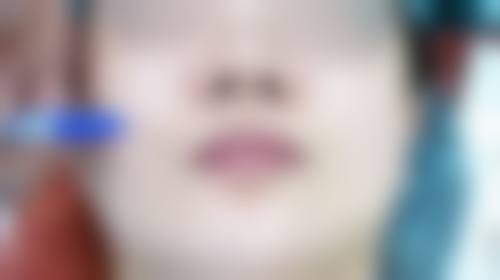 三、永嘉县东方整形外科门诊部诊疗项目有哪些?