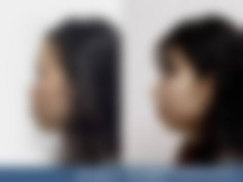 四、南京轻颜医疗美容诊所特色项目