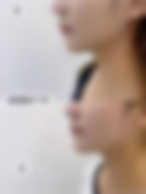 八、梅州方圆整形医疗美容门诊部真实的患者评价