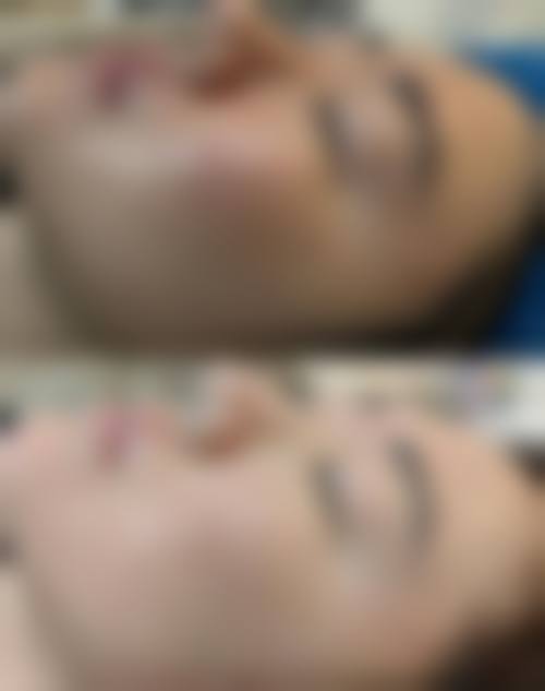 八、南京轻颜医疗美容诊所真实的患者评价