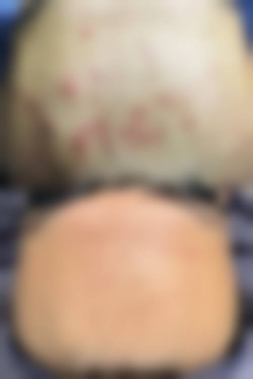 五、西安聚美汇医疗美容门诊部价格表