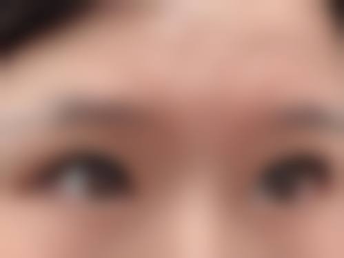 四、宁波美莱整形医院特色项目