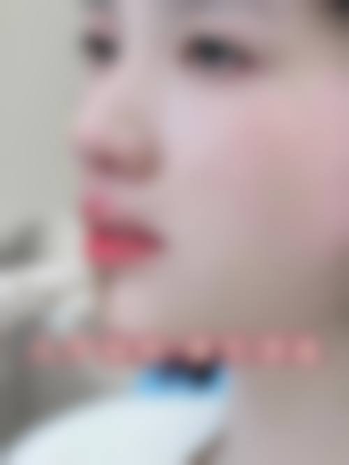 四、太原曼姿妍医疗美容诊所特色项目