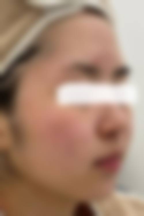 六、成都亚太美容医院价格表