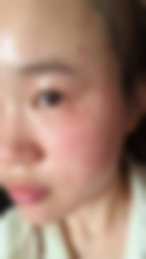 八、广州阳光医学美容门诊部预约方式