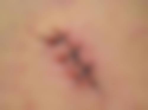 九、宁波美莱整形医院真实的患者评价