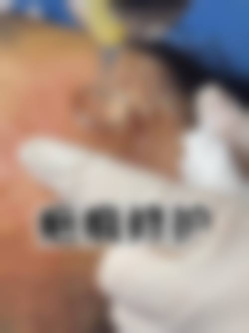 四、毕节爱侈医疗美容门诊部特色项目