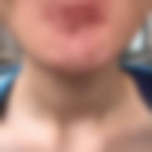 四、西安市第九医院烧伤整形门诊部特色项目