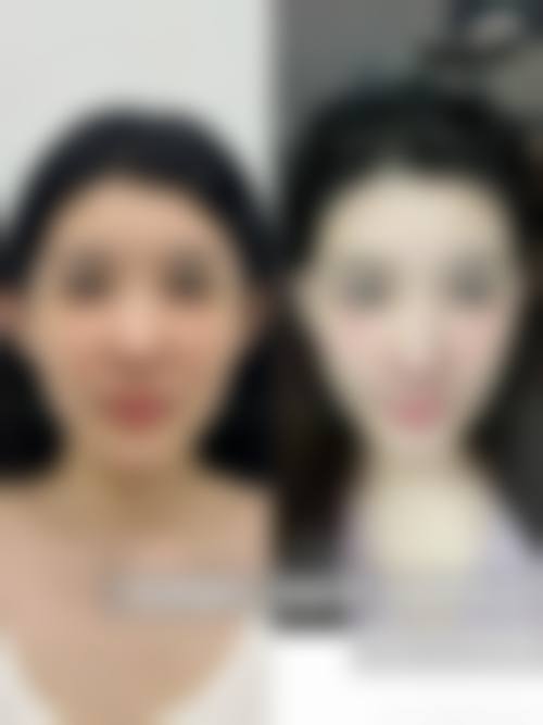 八、福建福州靓颜医疗美容门诊预约方式