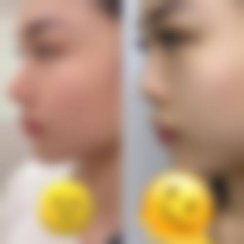 宁波海曙美莱医疗美容门诊部价格表