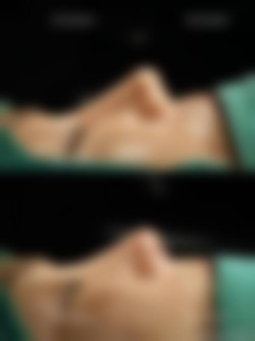 四、无锡虹桥医院医疗美容科（植发专精）特色项目