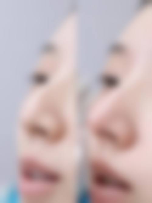 三、合肥壹美尚整形医院诊疗项目有哪些？