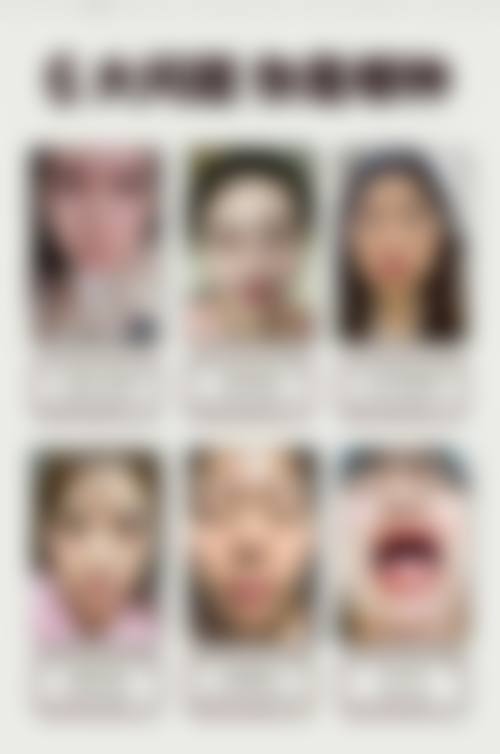 二、梅州方圆整形医疗美容门诊部怎么样？