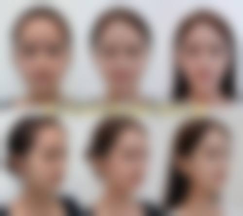 四、西安美托邦医疗美容门诊部特色项目