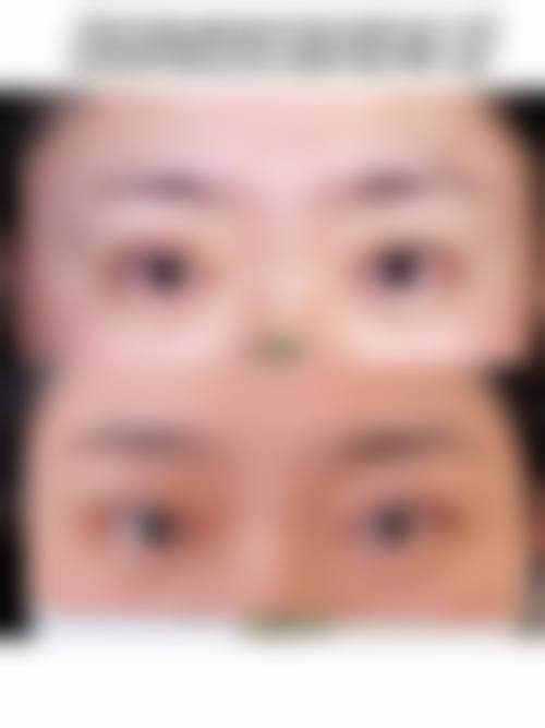 四、湖南娄底美科整形美容医院特色项目