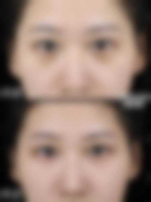 七、中日友好医院西区预约方式