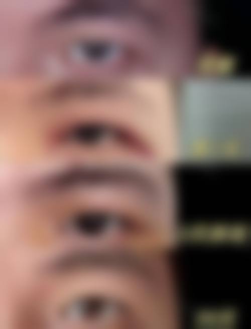 六、合肥壹美尚整形医院价格表