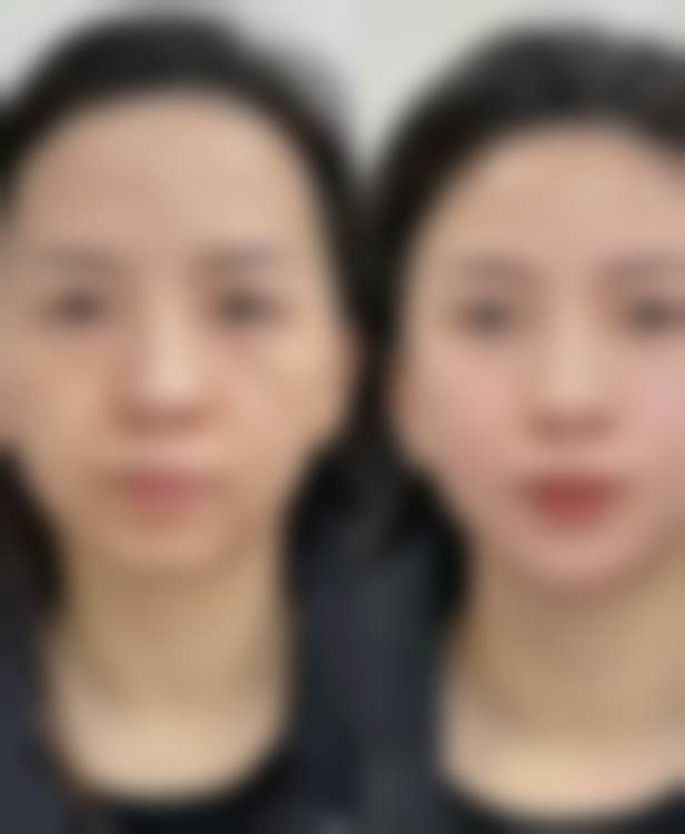 三、湖南娄底美科整形美容医院诊疗项目有哪些？