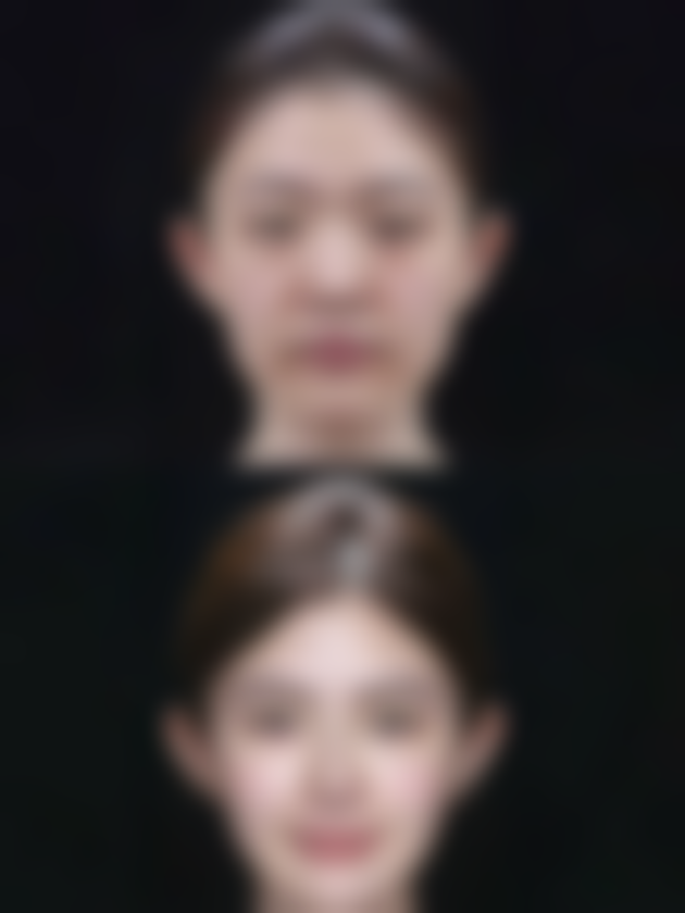 二、怎么样去烫伤的疤痕之分层治疗方案