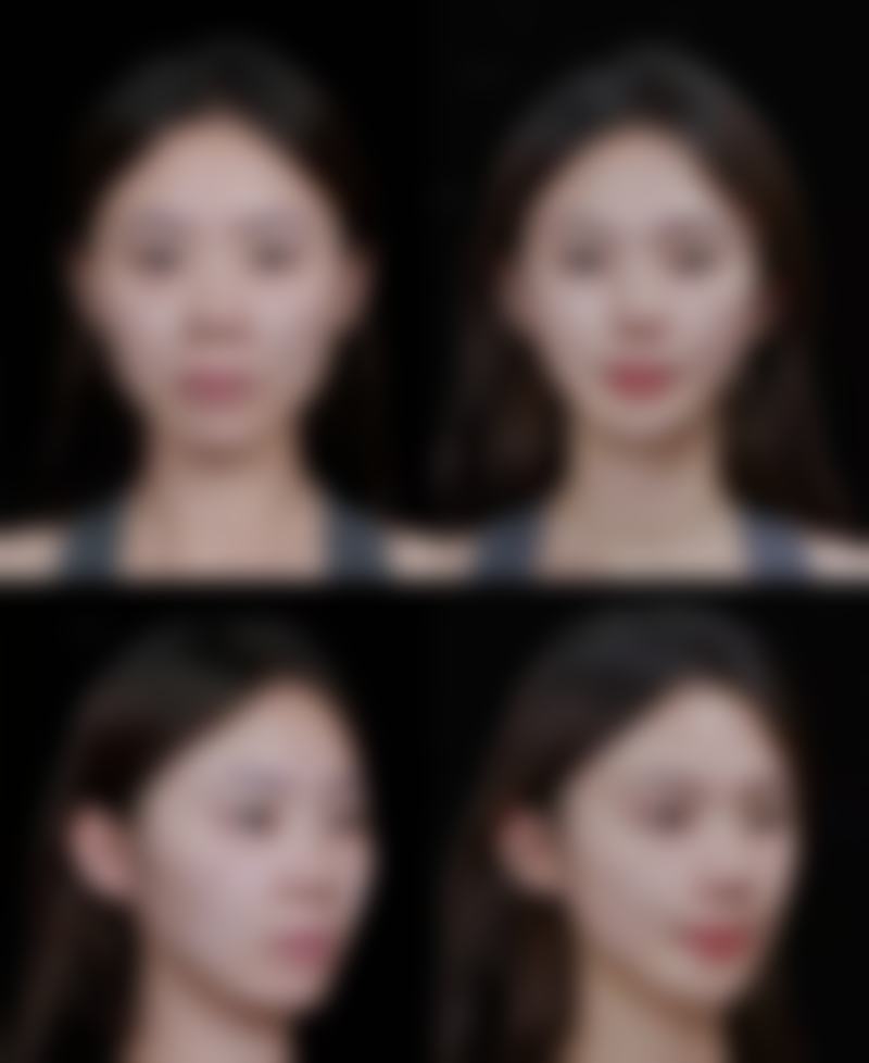 八、湖南娄底美科整形美容医院真实的患者评价