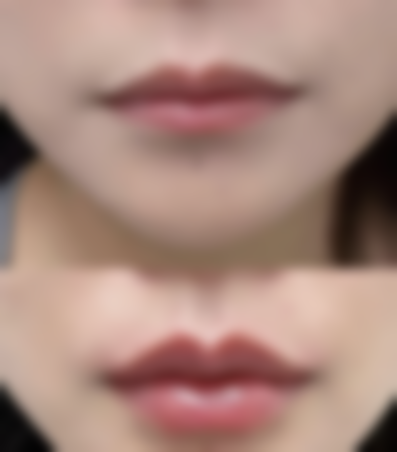 二、武汉正璞医疗美容怎么样？