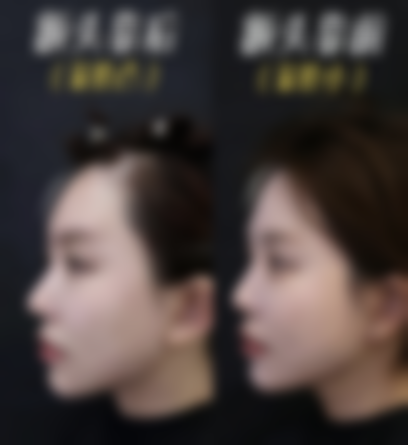 二、缝针所疤痕早期护理的重要性及方法