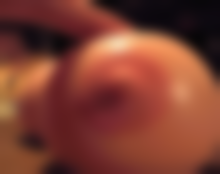 三、割包皮术后可能产生的影响及注意事项