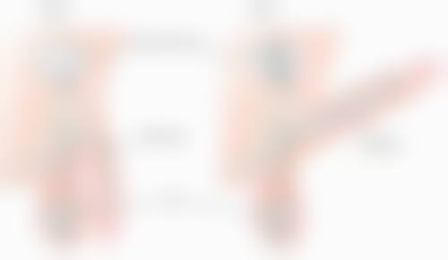 双眼皮术后怎么消肿快？掌握这些最快方法，让你眼部快速恢复自然！ 