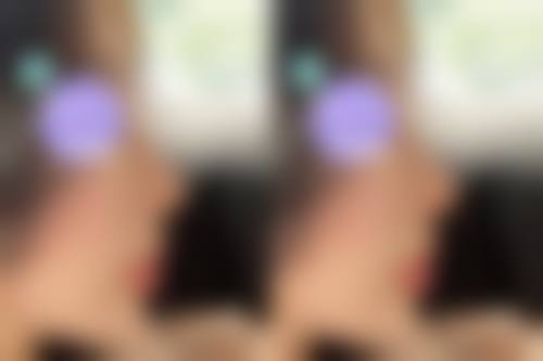 三、汕头紫馨医疗整形诊疗项目有哪些？