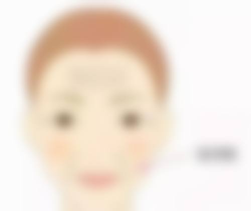 三、双眼皮可吸收线吸收过程中的注意事项