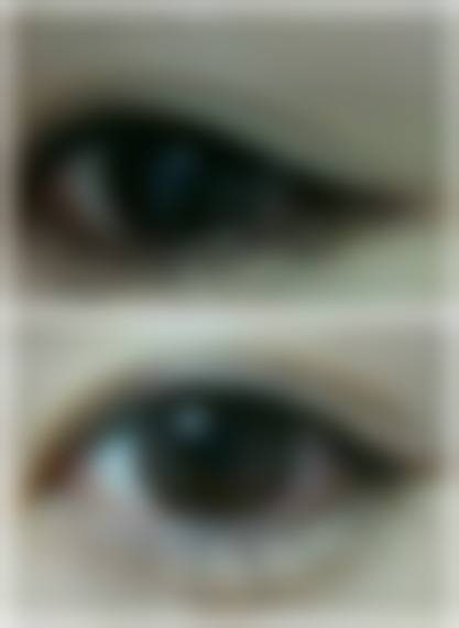 四、广汉熹亚七度整形医院特色项目