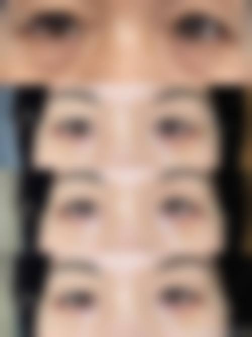 四、韩国SIGNATURE整形外科特色项目