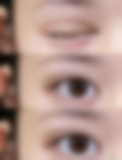 八、医巢（杭州）整形医疗真实的患者评价