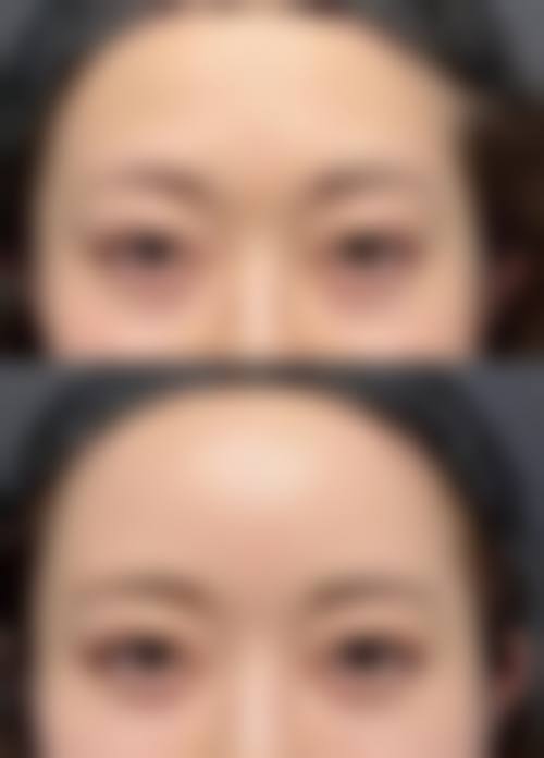 七、广汉熹亚七度整形医院预约方式