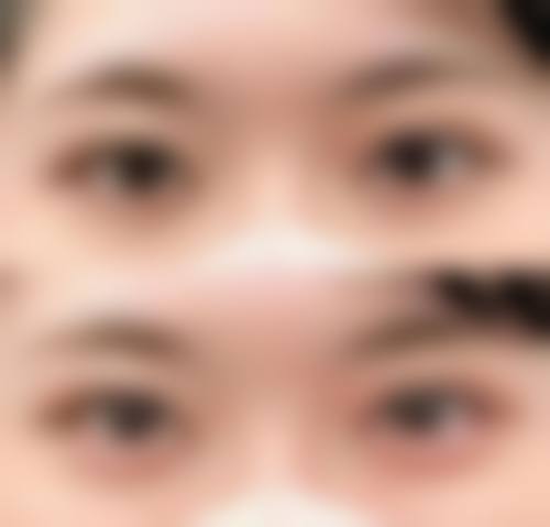 八、深圳容术医疗整形美容真实的患者评价