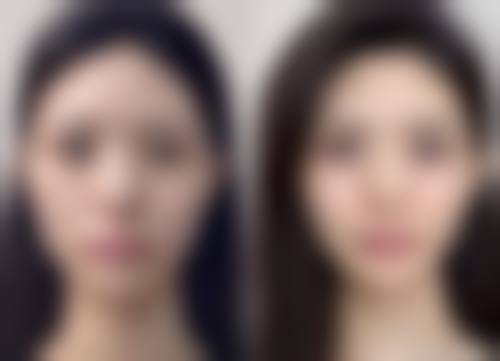 四、广州唯伊整形医院特色项目