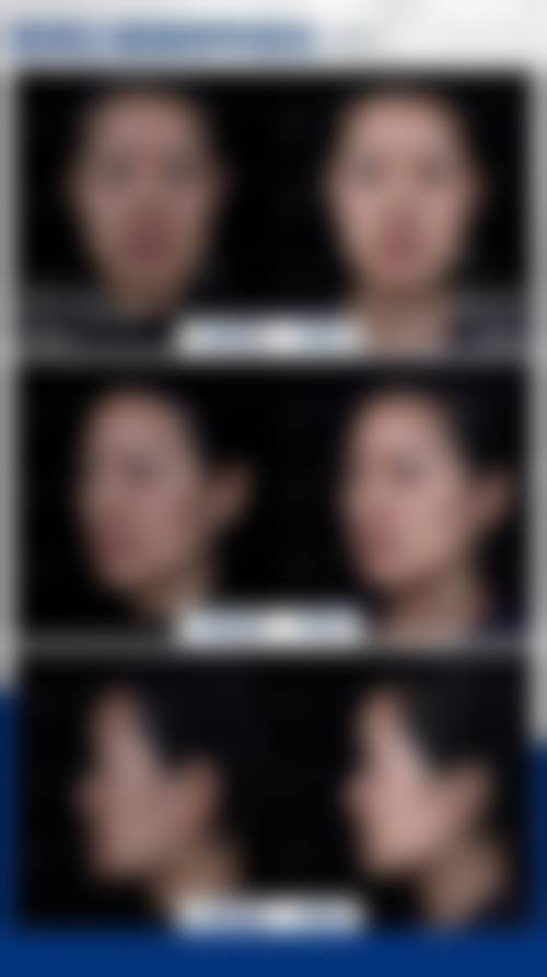 二、宿迁微悦医疗美容门诊部怎么样？