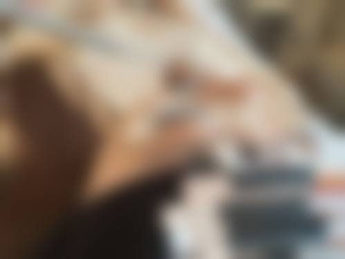 九、南京长江医院植发科真实的患者评价