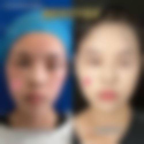 三、湖北武汉壹点美医疗美容诊疗项目有哪些?