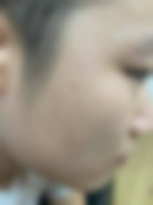 五、安顺丽都(爱美丽)医疗美容诊所价格表