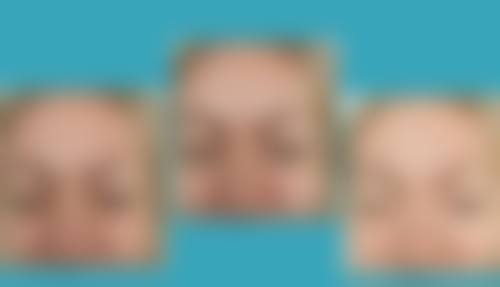 三、广汉熹亚七度整形医院诊疗项目有哪些?