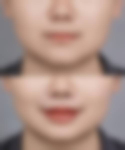 四、新疆伊丽莎白整形医院特色项目