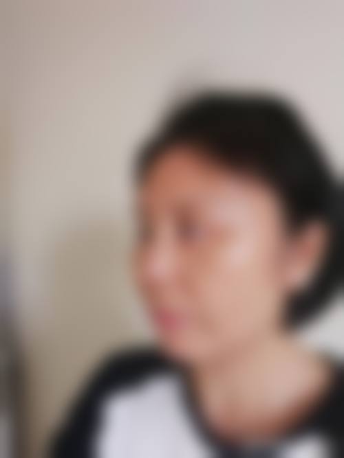 四、深圳容术医疗整形美容特色项目