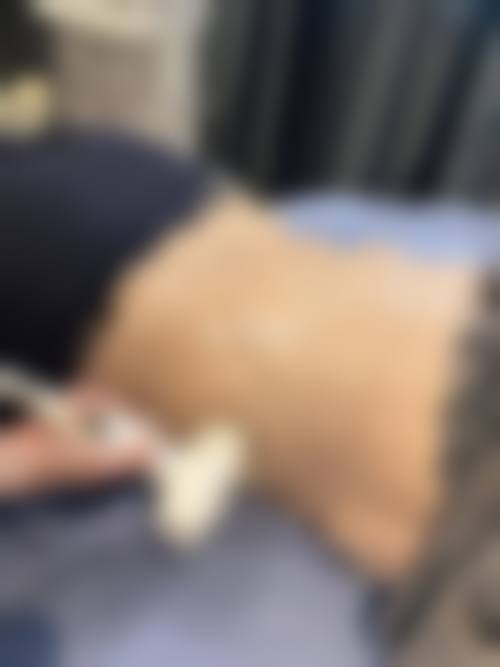 四、益阳爱思特医疗美容医院有限公司特色项目