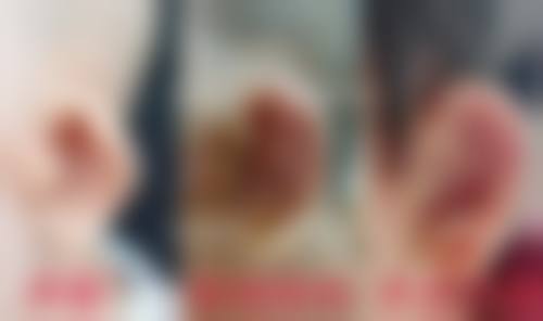 四、郑州市金水区康伦医疗美容门诊部特色项目