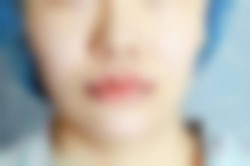 四、安徽医 科 大学第一附属医院(整形外科)特色项目